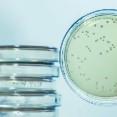 Timeline: ACONTECIMIENTOS MICROBIOLOGÌA