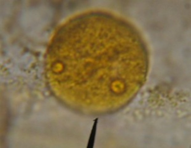 Discovery of Nucleus (continued)