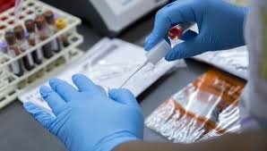 ESTUDIOS DE EPIDEMIOLOGIA