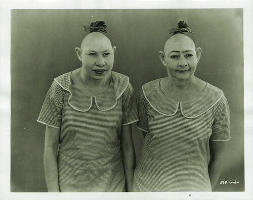 GENTE CON DEFORMIDADES