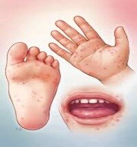 La Fiebre Aftosa es detectada y confirmada.