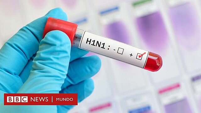 H1N1
