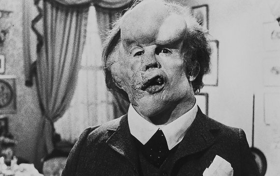 Primer aparición del "Hombre elefante"