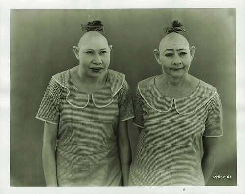 Gente con deformidades