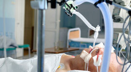 Timeline: Ventilación mecánica