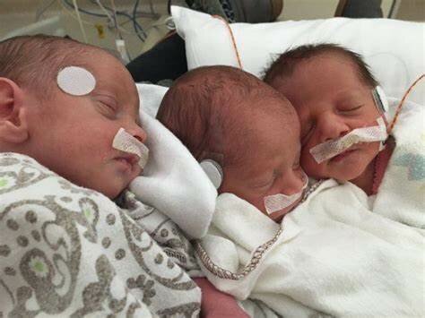 Triplets in the NICU