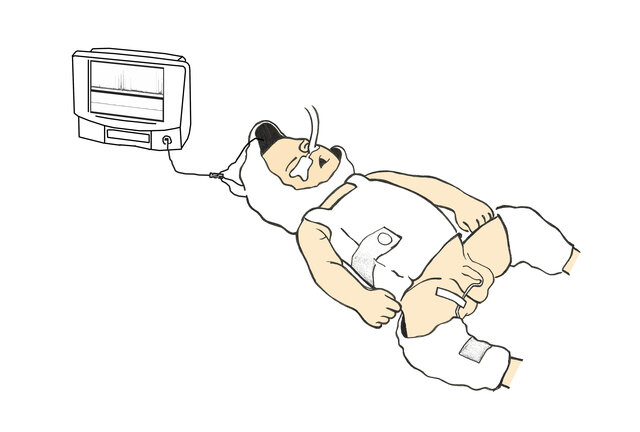 Encefalopatía hipóxico-isquémica