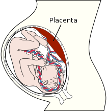 Asfixia Perinatal