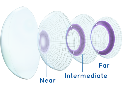 Primeros lentes multifocales desechables.