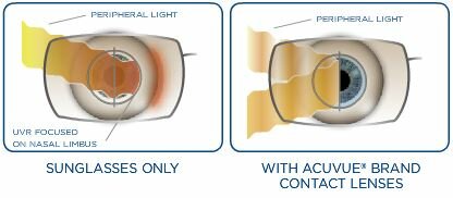 Introducción de el filtro UV en lentes de contacto