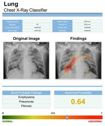 Diagnostico asistido