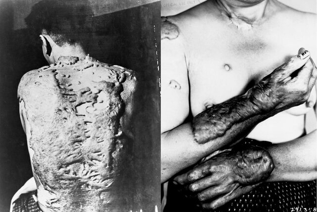 Cuantos muertos hubo en las dos explociones