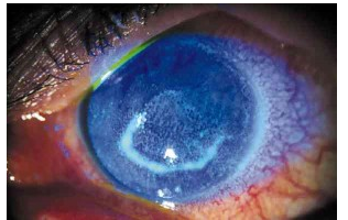 Peróxidos de hidrógeno.