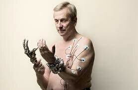 Implante cibernético