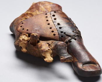 La segunda Prótesis