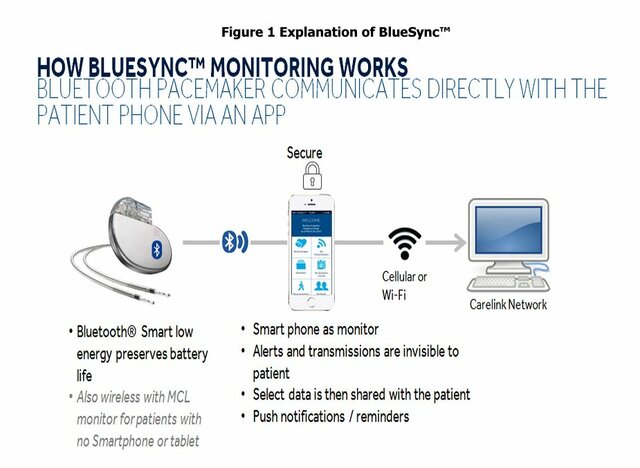 Bluesync Field Evaluation Pacemakers
