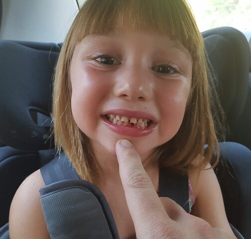 Se me cayó el primer diente