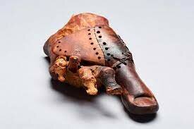 INVENCIÓN DE LA PRIMERA PROTESIS