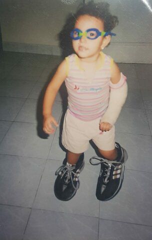 Mi Primer Hueso Roto