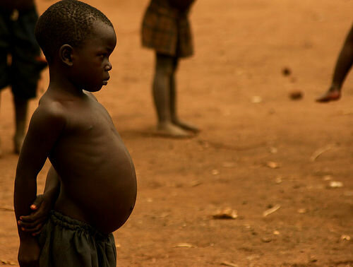 Descubrimiento del Kwashiorkor