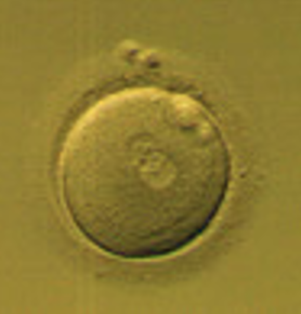 First Trimester: Day 1