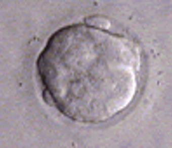 First Trimester: Day 4