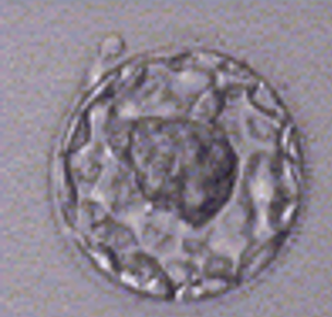 First Trimester: Day 5