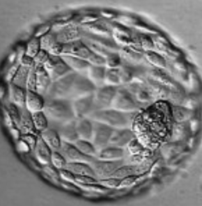 First Trimester: Day 6