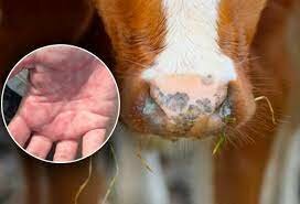 La brucelosis el origen