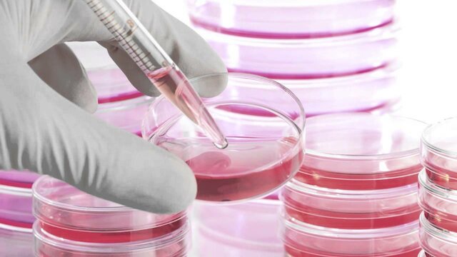 Terapia con células madre