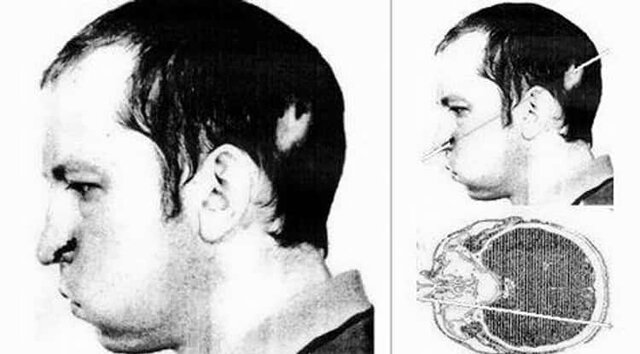Muerte de Anatoli Bugorski por acelerador de partículas