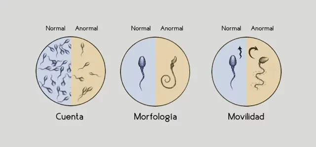 Compocicion elemental del semen