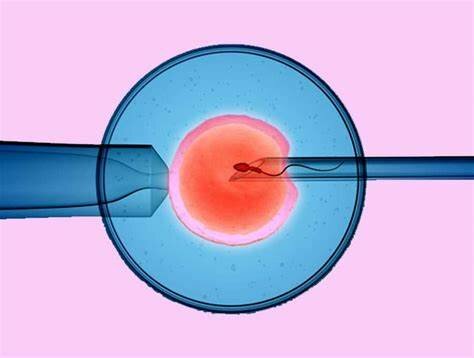 Fecundación in Vitro Carl Wood