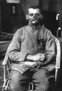 one of the "men with broken faces"