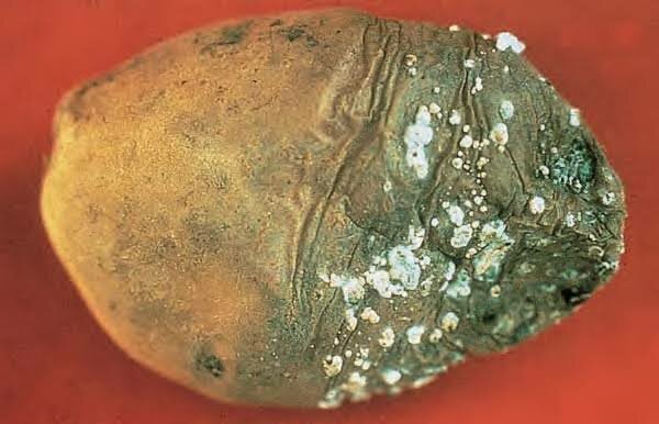 Podredumbre de la patata