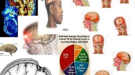 Timeline: Traumatic Brain Injury