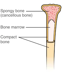 Bone Marrow Transplant