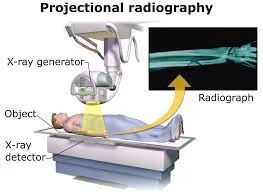 X-ray machine