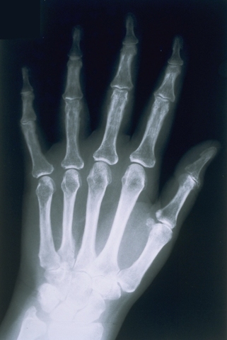 Wilhelm Conrad Röntgen