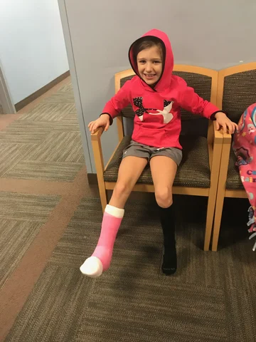 I broke my leg.