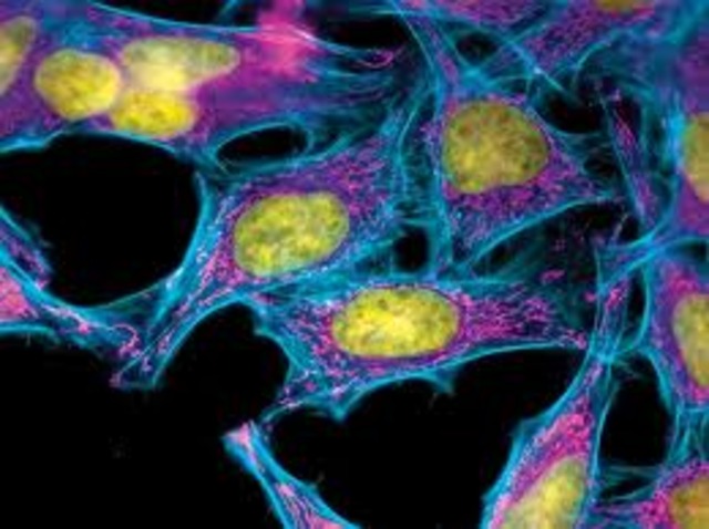 HeLa cells are discovered