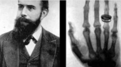 1895 - Wilhelm Conrad Röntgen