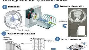 Exemplos de equipamentos.