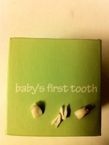 First permanent tooth