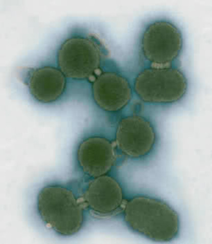 Synthia, the first synthetic living cell