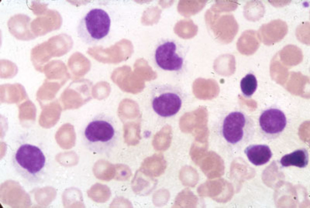 John Moore's Diagnosis