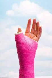 9 years old broken arm