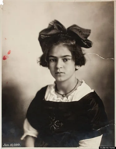 Frida Contracts Polio