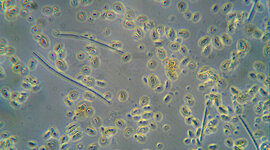 Timeline: Germ Theory Of Disease Year Only Timeline