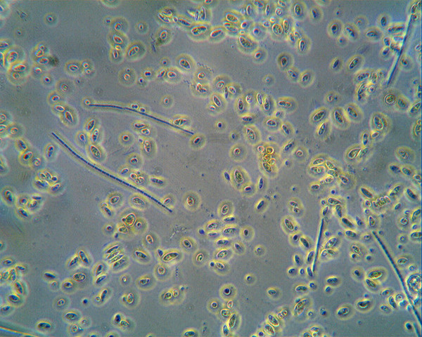 Leeuwenhoek Discovers Microorganisms